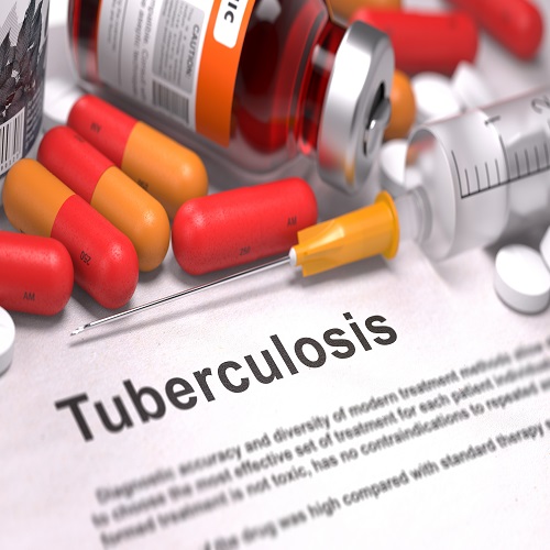 Diagnosis - Tuberculosis. Medical Concept.